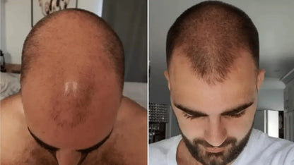 SADOER®  ¡Recupera y reduce la caída de tu cabello! (500ml)
